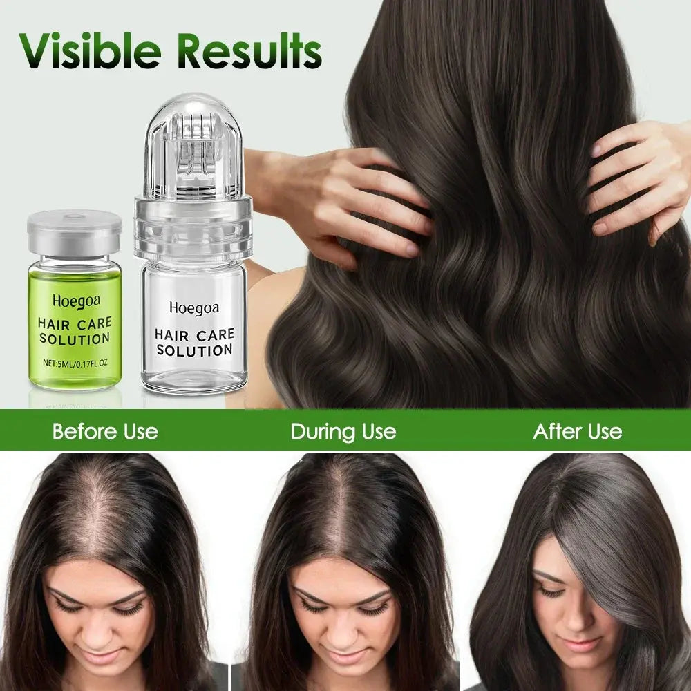 Hair Essential Care Serum Strengthen Roots Reducing Loss Prevent Baldness Nourish Scalp Hair Care Anti-Hair Loss Conditioner theelegancejewellery