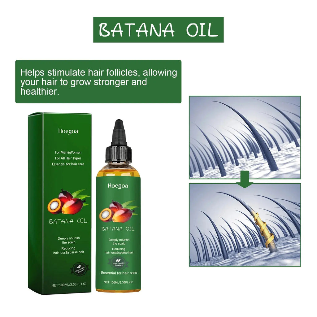 Hair Growth Oil Nourishing Scalp Repairing Strengthening Preventing Hair Loss Dry Damaged Frizz Control Men Women Hair Products theelegancejewellery
